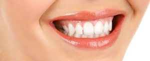 Things to know about dental veneers
